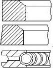 FAI AutoParts PR29-000 - Kit fasce elastiche autozon.pro