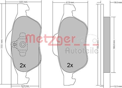 Metzger 1170155 - Kit pastiglie freno, Freno a disco autozon.pro