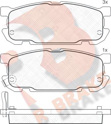 R Brake RB1541 - Kit pastiglie freno, Freno a disco autozon.pro