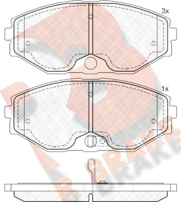 R Brake RB1569 - Kit pastiglie freno, Freno a disco autozon.pro