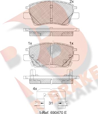 R Brake RB2311 - Kit pastiglie freno, Freno a disco autozon.pro