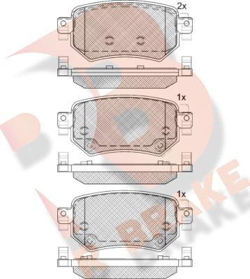 R Brake RB2263 - Kit pastiglie freno, Freno a disco autozon.pro