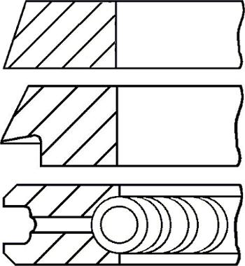 Wilmink Group WG1096525 - Kit fasce elastiche autozon.pro