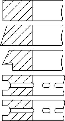 Wilmink Group WG1187664 - Kit fasce elastiche autozon.pro