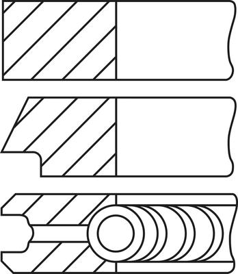 Wilmink Group WG2191580 - Kit fasce elastiche autozon.pro